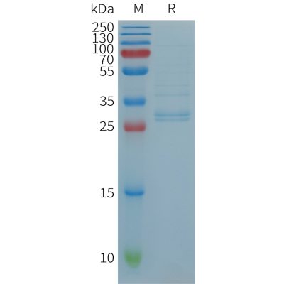 sp-PME101236 CCL19 Fig.1 SDS PAGE 1