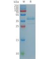 sp-PME101237 TGFA Fig.1 SDS PAGE 1