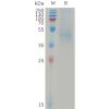 sp-PME101239 DKK1 Fig.1 SDS PAGE 1
