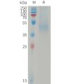 sp-PME101239 DKK1 Fig.1 SDS PAGE 1