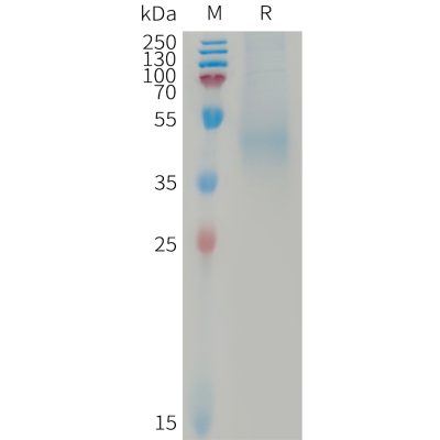 sp-PME101239 DKK1 Fig.1 SDS PAGE 1