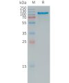 sp-PME101240 APLP2 Fig.1 SDS PAGE 1