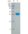 sp-PME101241 CXADR Fig.1 SDS PAGE 1