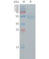 sp-PME101243 RHOB Fig.1 SDS PAGE 1