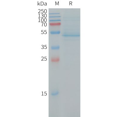 sp-PME101244 RHOC Fig.1 SDS PAGE 1