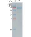 sp-PME101245 DKK1 Fig.1 SDS PAGE 1