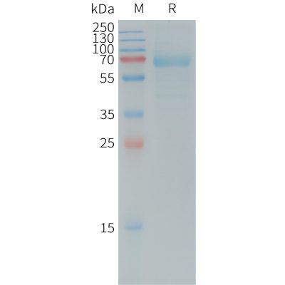 sp-PME101245 DKK1 Fig.1 SDS PAGE 1