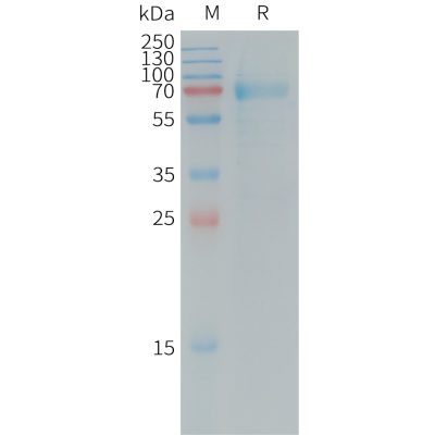 sp-PME101248 IL20RA Fig.1 SDS PAGE 1