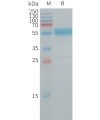 sp-PME101250 IL19 Fig.1 SDS PAGE 1