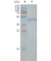 sp-PME101251 LY6H Fig.1 SDS PAGE 1