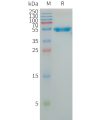 sp-PME101252 LAIR1 Fig.1 SDS PAGE 1