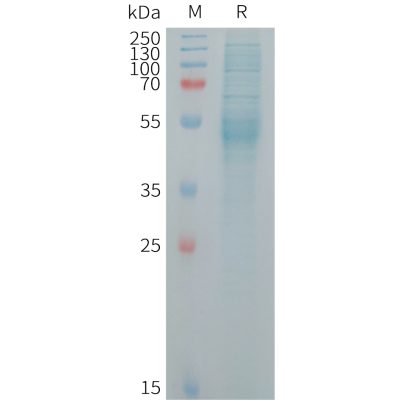 sp-PME101253 KREMEN2 Fig.1 SDS PAGE 1