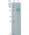 sp-PME101256 FCRL2 Fig.1 SDS PAGE 1