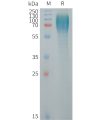 sp-PME101257 ICAM3 Fig.1 SDS PAGE 1