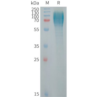 sp-PME101257 ICAM3 Fig.1 SDS PAGE 1