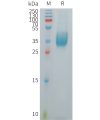 sp-PME101258 VSIG1 Fig.1 SDS PAGE 1