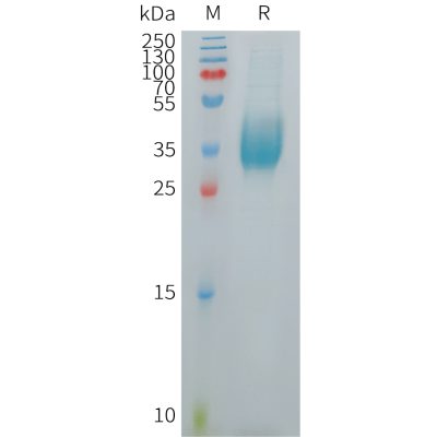 sp-PME101258 VSIG1 Fig.1 SDS PAGE 1