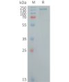 sp-PME101259 CD109 Fig.1 SDS PAGE 1