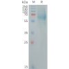 sp-PME101260 IGHE Fig.1 SDS PAGE 1
