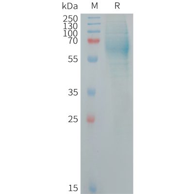 sp-PME101260 IGHE Fig.1 SDS PAGE 1