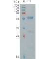 sp-PME101262 CLEC4A Fig.1 SDS PAGE 1