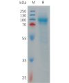 sp-PME101263 LRRN1 Fig.1 SDS PAGE 1