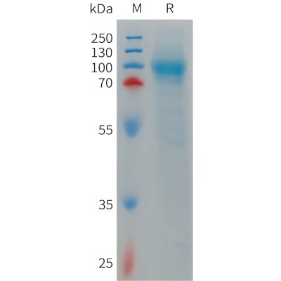 sp-PME101263 LRRN1 Fig.1 SDS PAGE 1