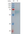 sp-PME101264 LRP10 Fig.1 SDS PAGE 1