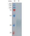 sp-PME101265 TNFRSF1B Fig.1 SDS PAGE 1