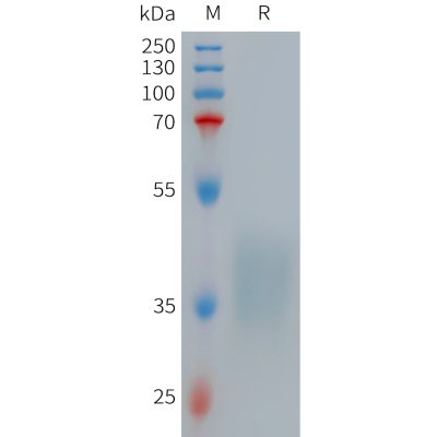 sp-PME101265 TNFRSF1B Fig.1 SDS PAGE 1