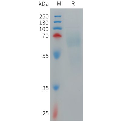 sp-PME101266 IL12AIL12B Fig.1 SDS PAGE 1