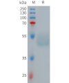 sp-PME101267 GIPR Fig.1 SDS PAGE 1