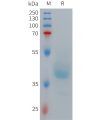 sp-PME101268 GRPR Fig.1 SDS PAGE 1