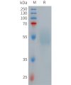 sp-PME101269 GLP1R Fig.1 SDS PAGE 1