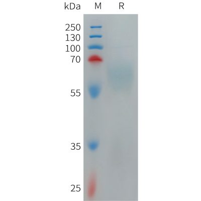 sp-PME101270 TMEM219 Fig.1 SDS PAGE 1