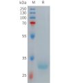 sp-PME101271 HAMP Fig.1 SDS PAGE 1