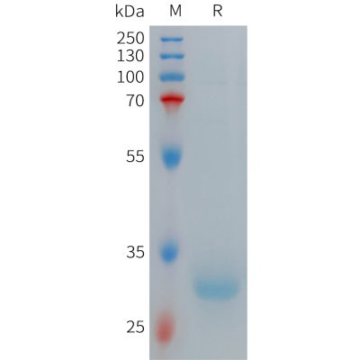 sp-PME101271 HAMP Fig.1 SDS PAGE 1