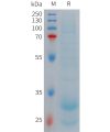 sp-PME101272 HAMP Fig.1 SDS PAGE 1