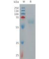 sp-PME101274 PILRA Fig.1 SDS PAGE 1