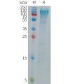 sp-PME101275 MANSC1 Fig.1 SDS PAGE 1