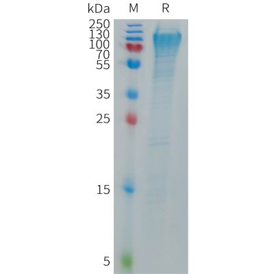 sp-PME101275 MANSC1 Fig.1 SDS PAGE 1