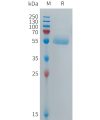 sp-PME101276 CPM Fig.1 SDS PAGE 1