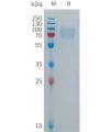 sp-PME101278 FCGR3B Fig.1 SDS PAGE 1