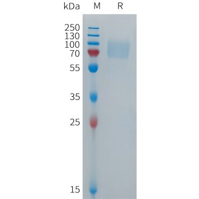 sp-PME101278 FCGR3B Fig.1 SDS PAGE 1