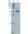 sp-PME101279 TAFA5 Fig.1 SDS PAGE 1