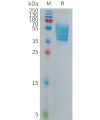 sp-PME101280 ECSCR Fig.1 SDS PAGE 1