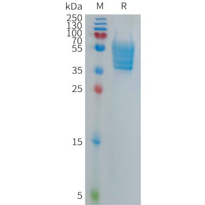 sp-PME101280 ECSCR Fig.1 SDS PAGE 1