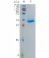 sp-PME101281 PF4V1 Fig.1 SDS PAGE 1