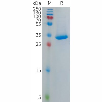 sp-PME101281 PF4V1 Fig.1 SDS PAGE 1