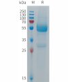 sp-PME101283 CD300LF Fig.1 SDS PAGE 1